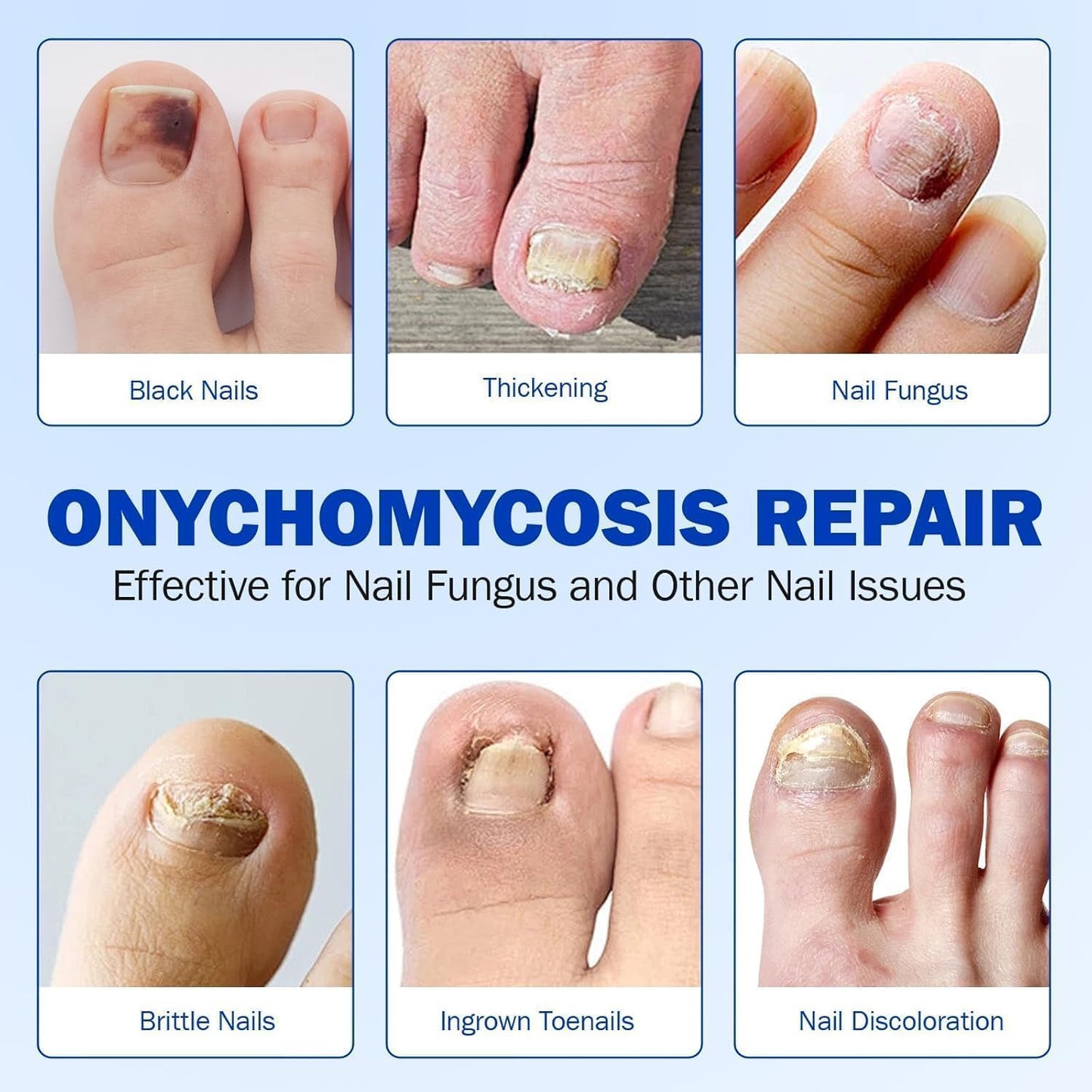 Fungal Nail Patch Treatment