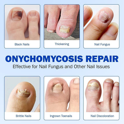 Fungal Nail Patch Treatment