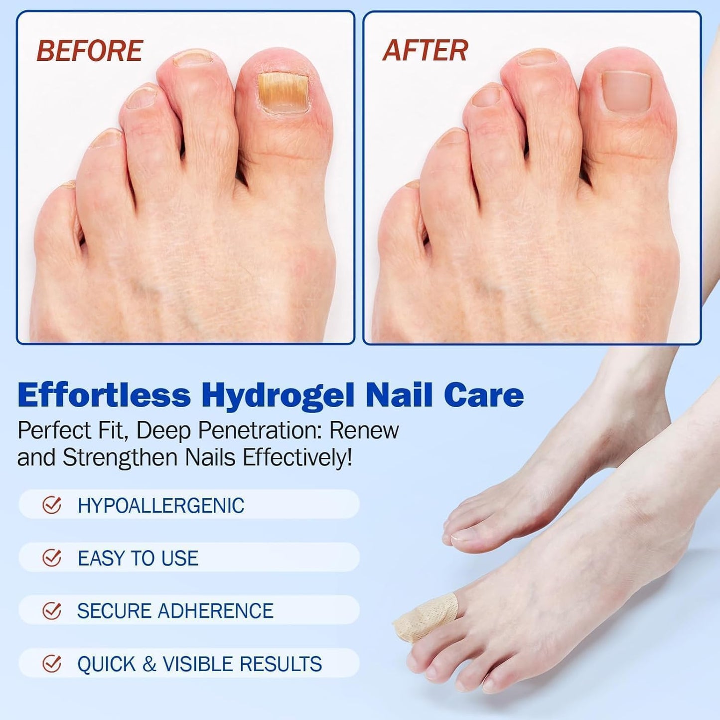 Fungal Nail Patch Treatment