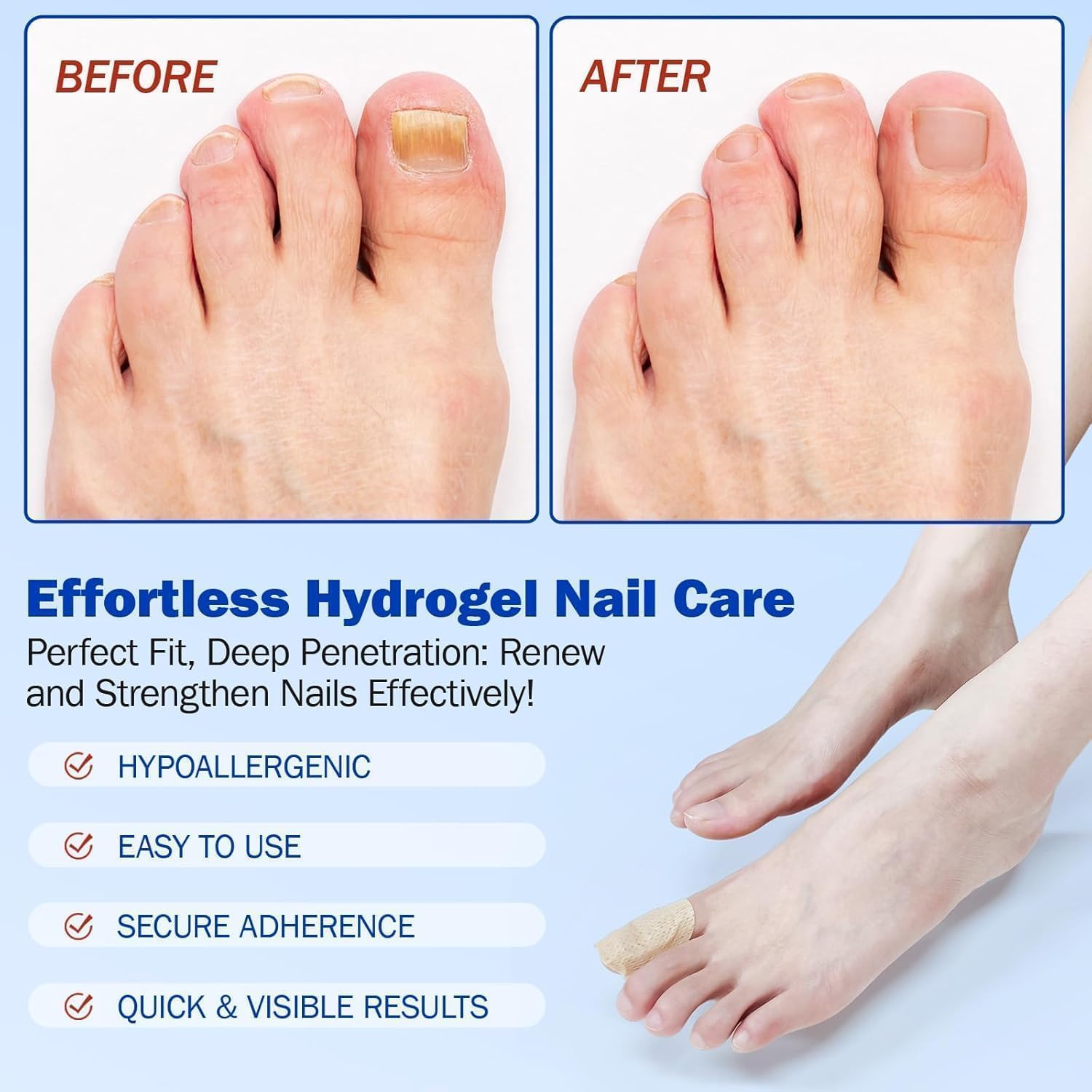 Fungal Nail Patch Treatment